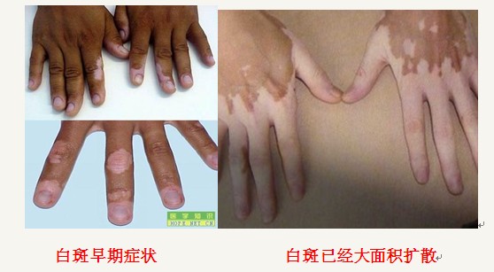 13-1112021Q04WP.jpg